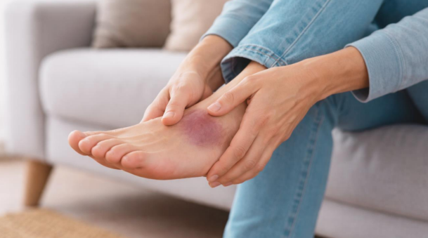 what is a contusion of the foot