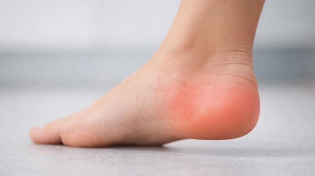 Close-up of heel pain illustrating is heel pain a sign of cancer concern